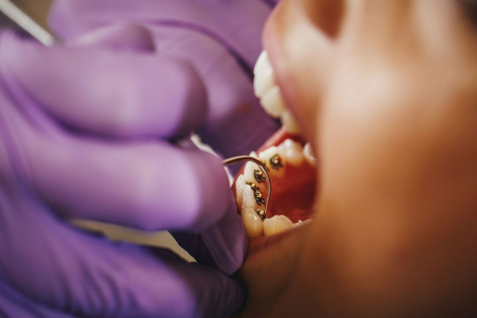 ¿Qué es la ortodoncia? Guía completa 4