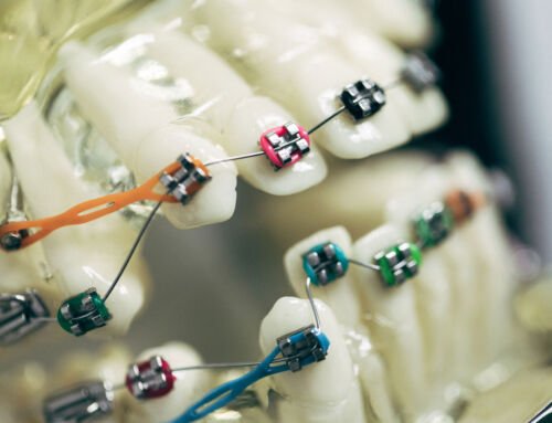 ¿Qué es la ortodoncia? Guía completa