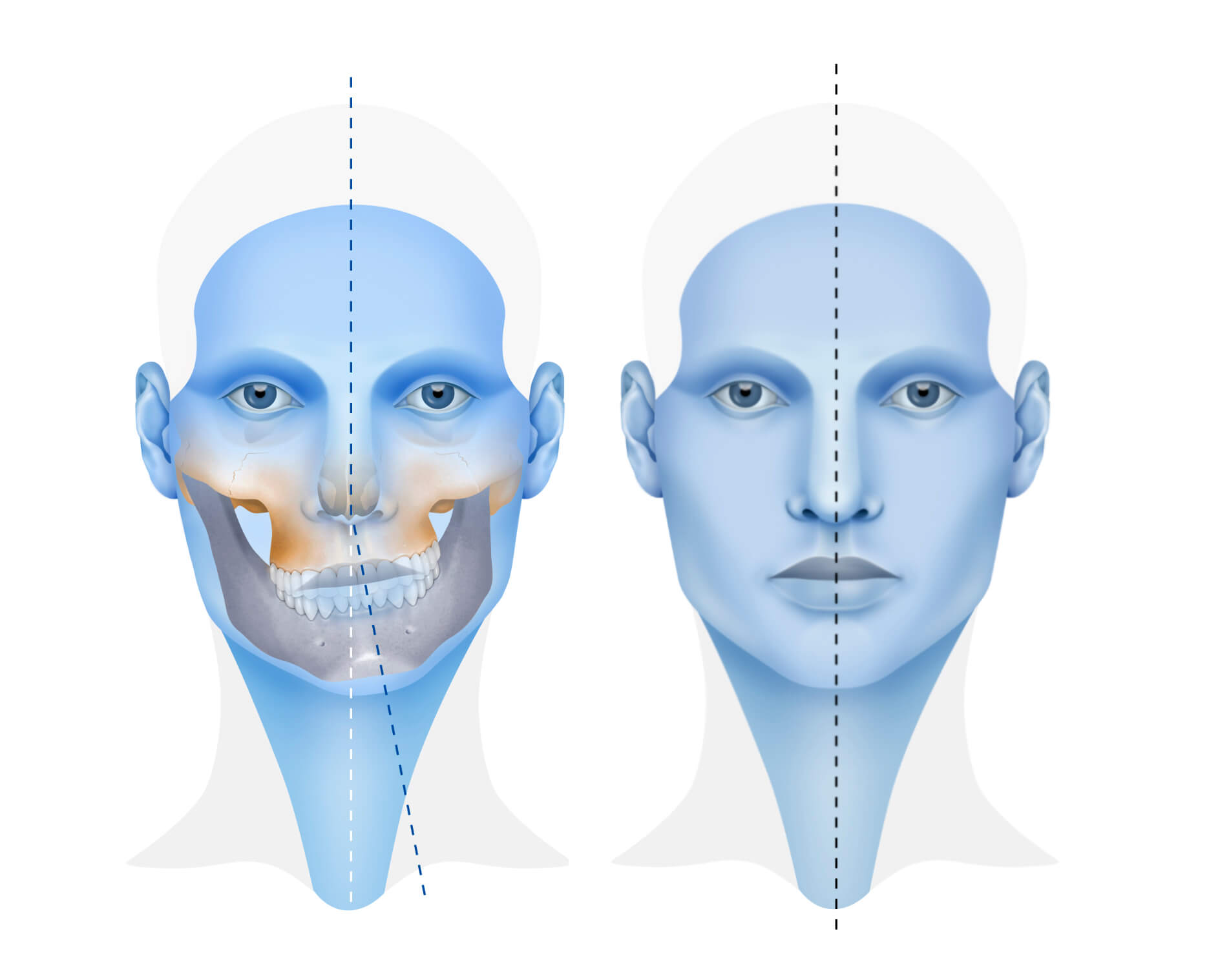 Asimetría facial: Qué es, tipos y tratamientos 1