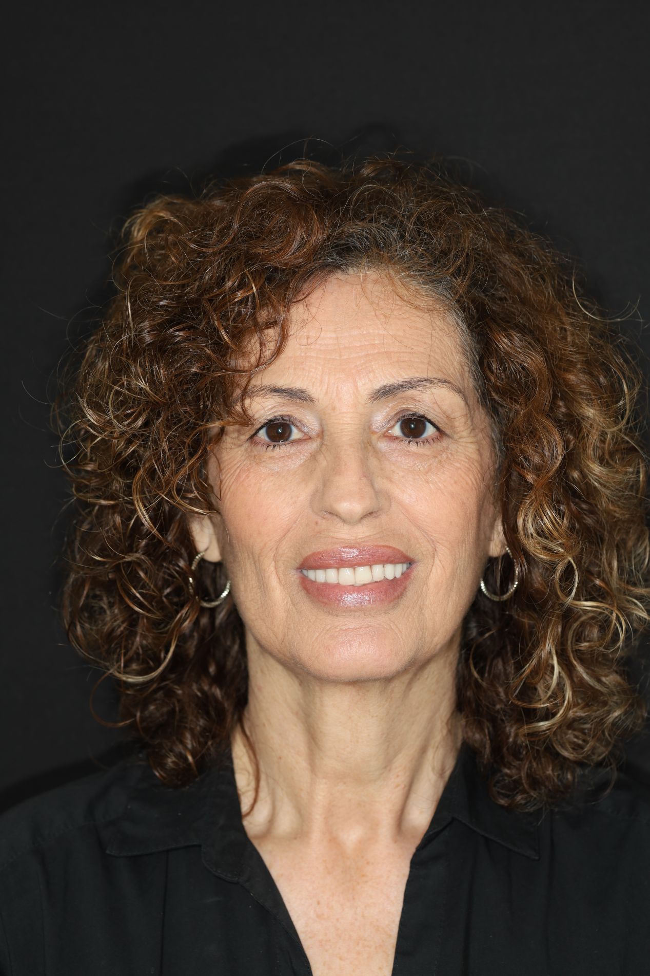 testimonio implantes dentales