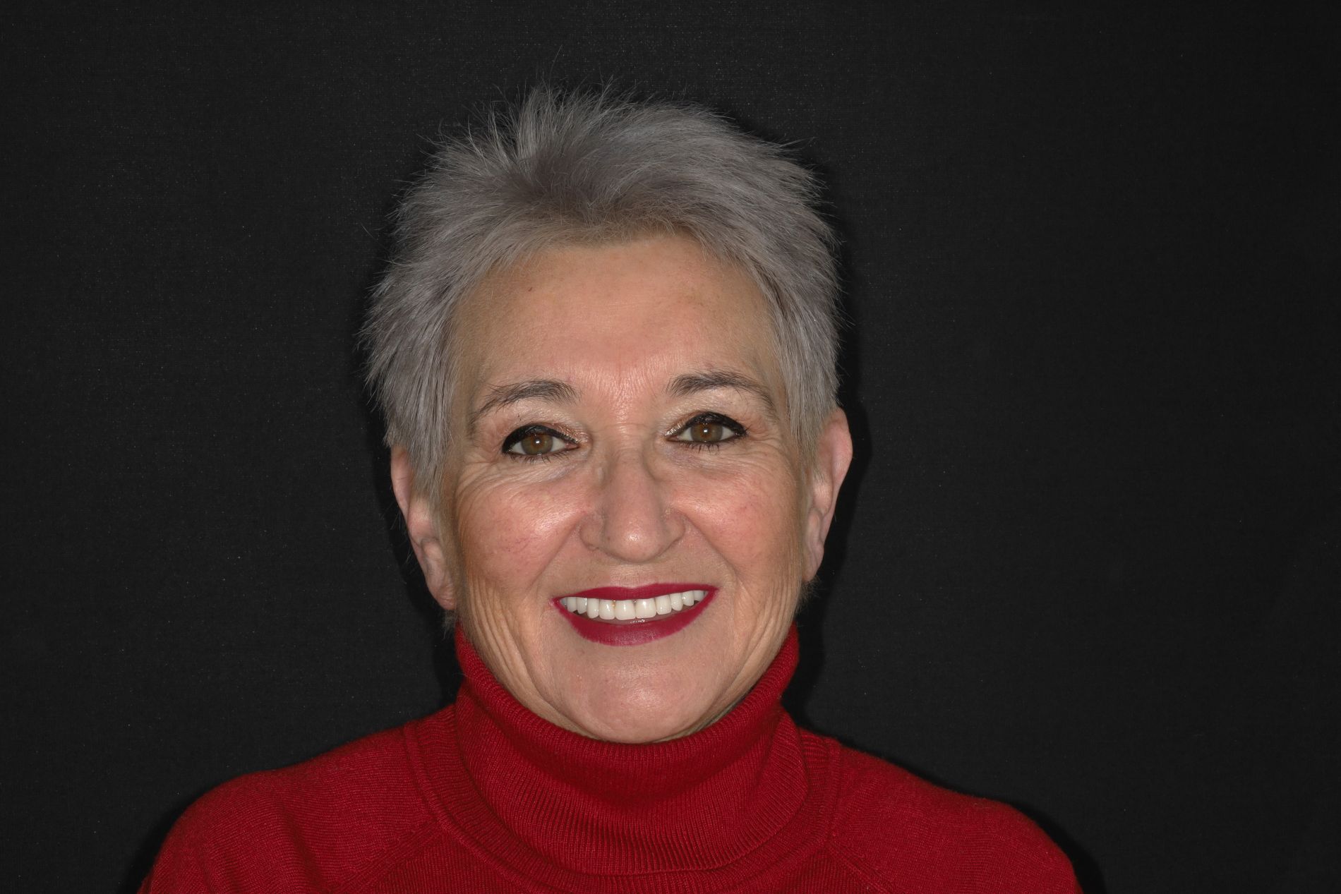 implantes dentales testimonio