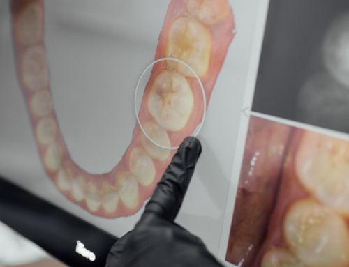 Cómo está revolucionando la Inteligencia Artificial la atención dental (y cómo te beneficia como paciente)