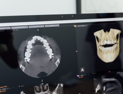 Por qué la falta de molares puede afectar tu salud bucal antes de los 50 años